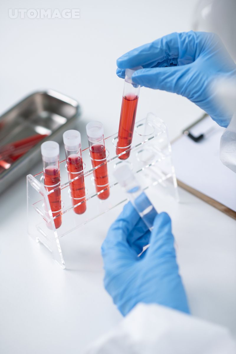 High-Tech Diagnostics Core